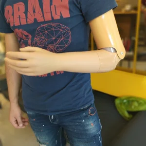 dirsek üstü kol protezi fiyatları