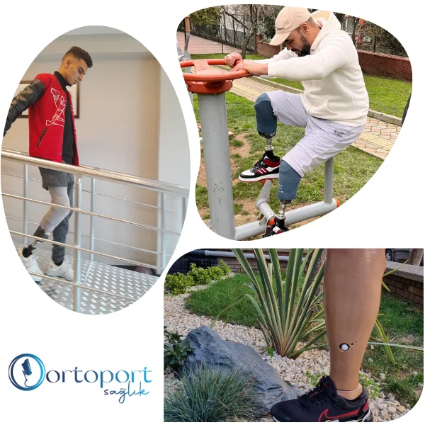 diz altı protez fiyatları